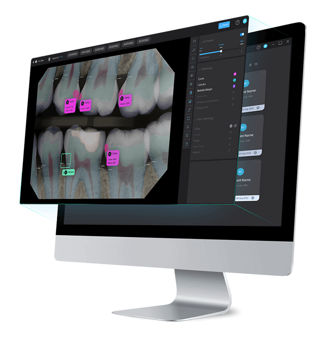 Pearl AI radiograph analysis Calgary dental clinic