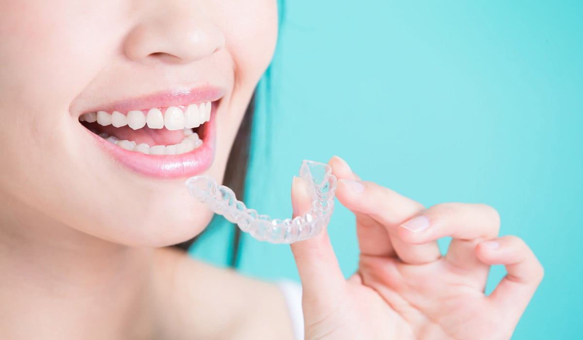 Invisalign Clear Aligners Calgary
