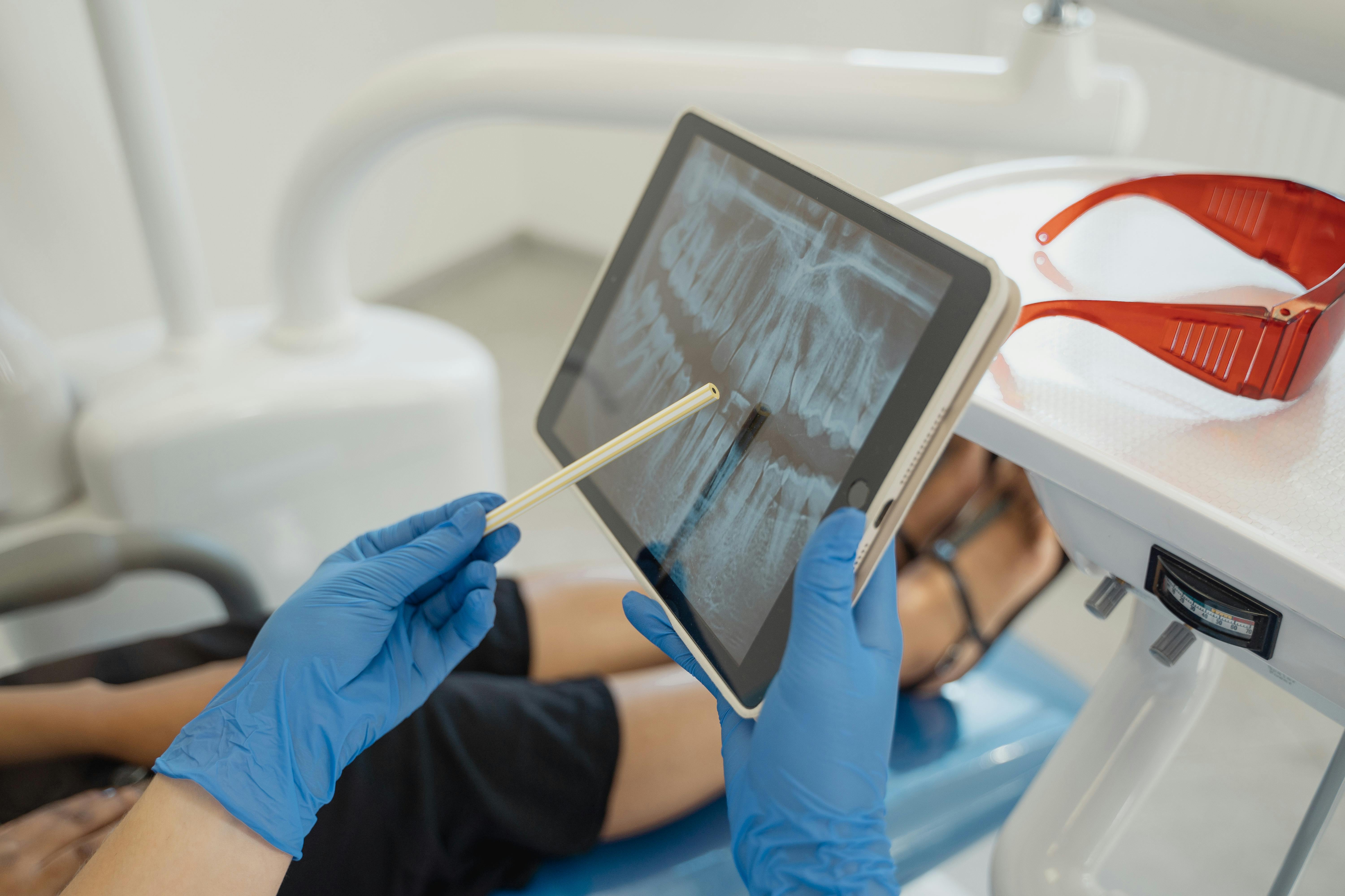 Root canal therapy Calgary NW